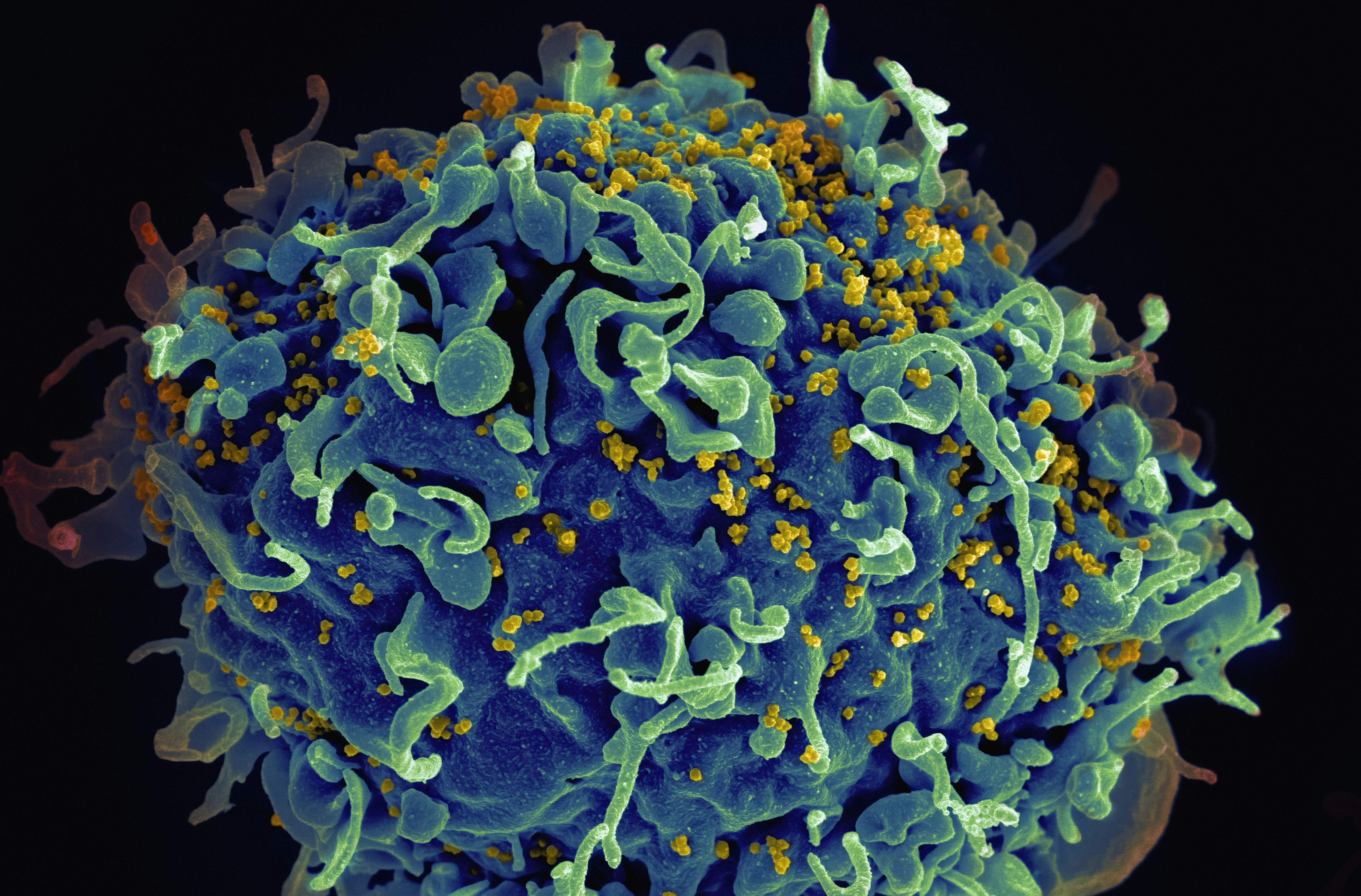 Infected